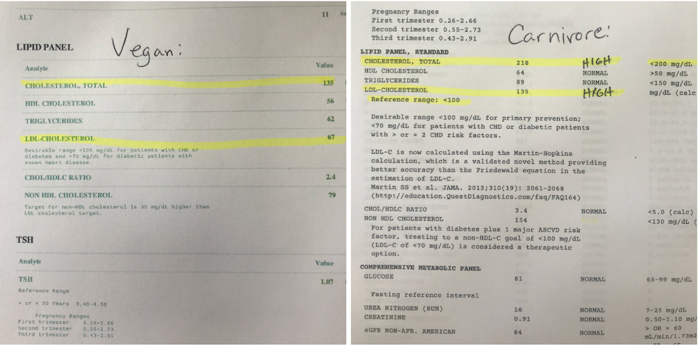 nutrition awareness, cholesterol results on carnivore diet